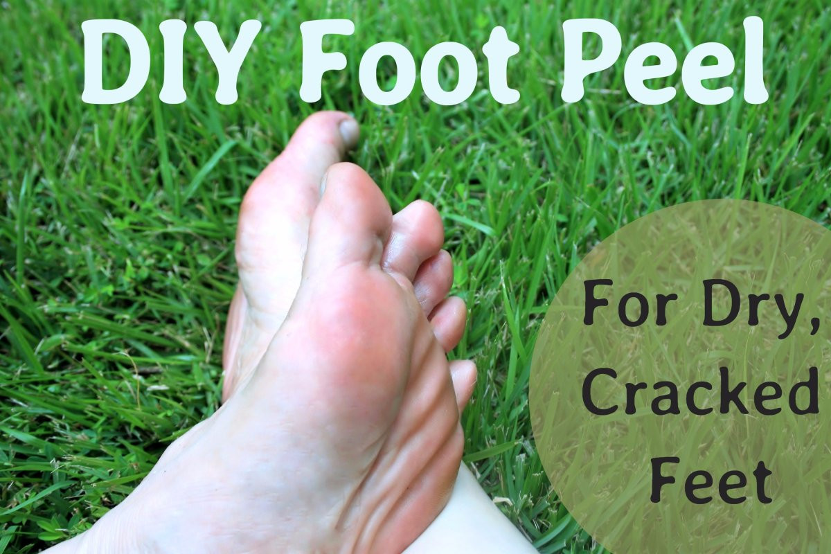 Baby Foot Peel DIY
 A DIY Peel for Dry Cracked Feet
