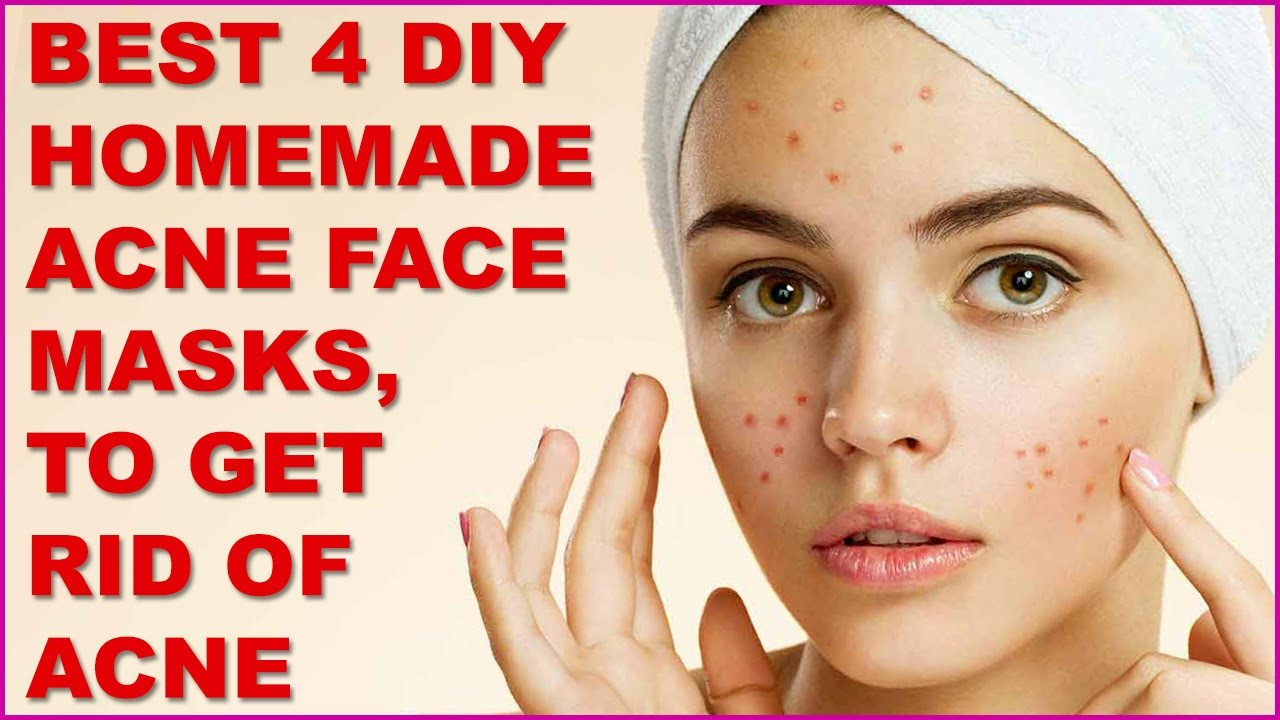 Best DIY Acne Mask
 Best 4 DIY Homemade Acne Face Masks To Get Rid Acne