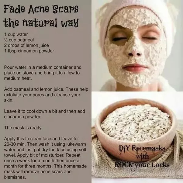 Best DIY Acne Mask
 What are the best DIY face masks for acne scars Quora