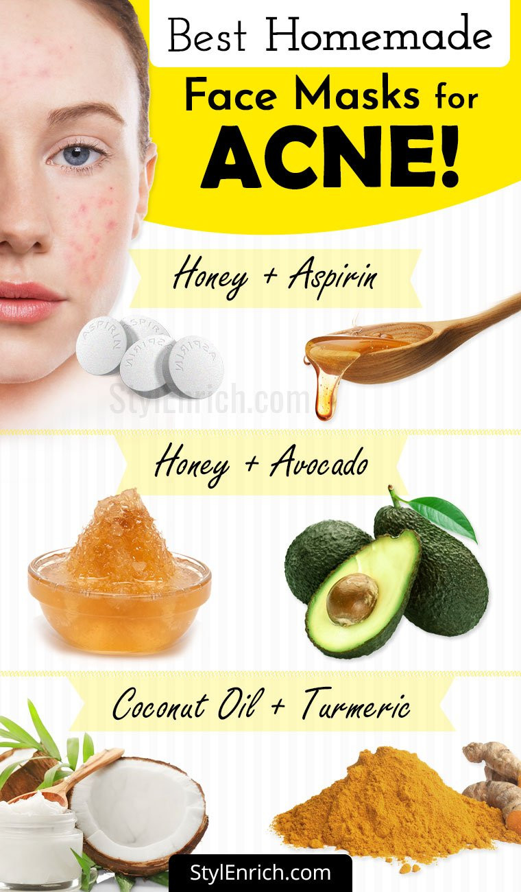 Acne Facial Mask DIY
 Homemade Face Mask For Acne Treatment At Home