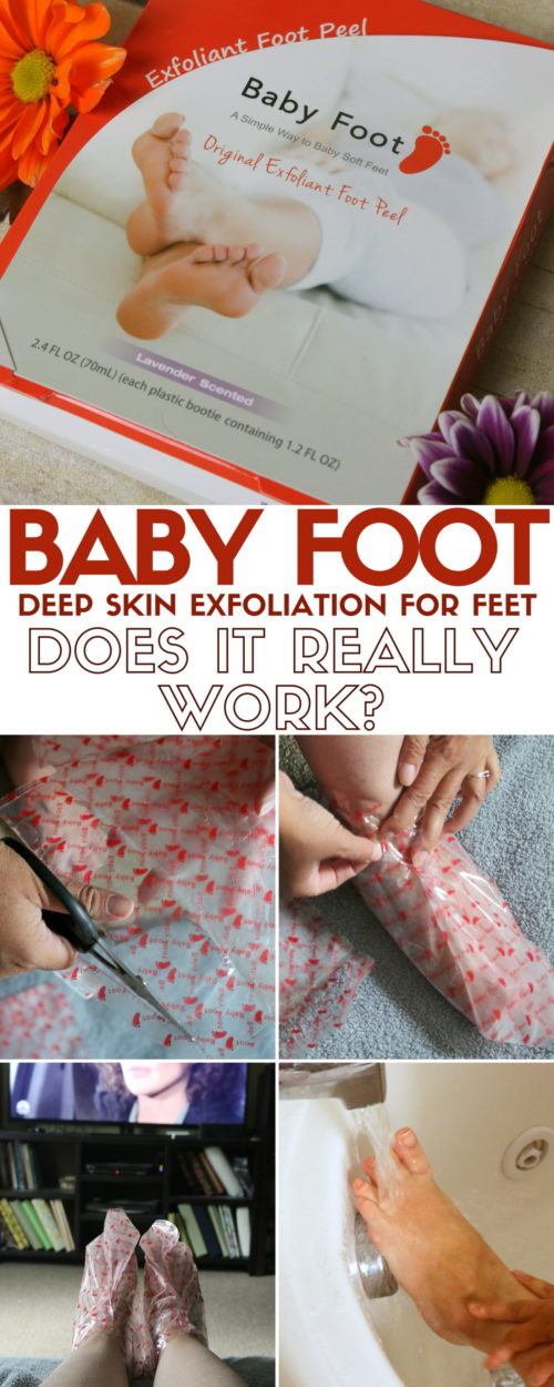 Baby Foot Peel DIY
 Does Baby Foot Really Work