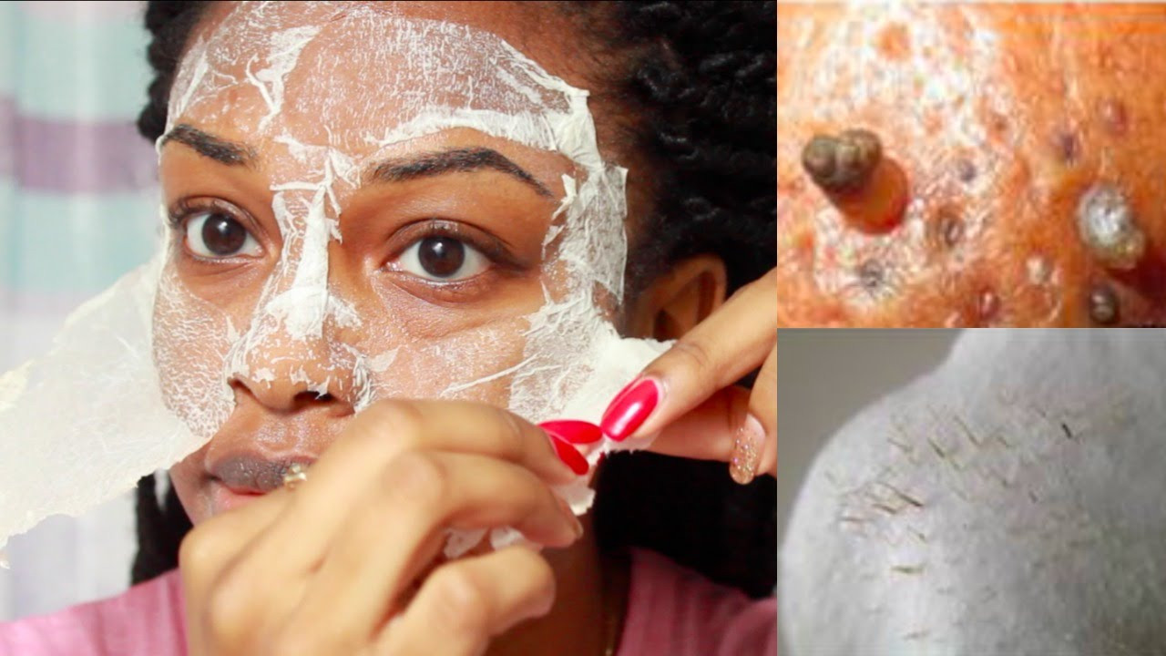 DIY Black Face Mask
 EASY DIY Egg Blackhead Remover Peel f Mask