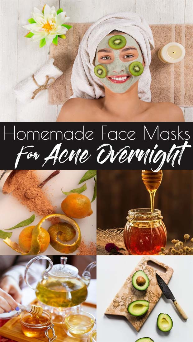 DIY Face Mask For Acne And Blackheads
 Homemade Face Masks For Acne Clear Skin