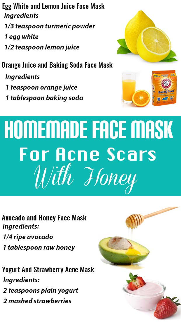 DIY Face Mask For Acne And Blackheads
 Homemade Face Masks For Blackheads And Pimples