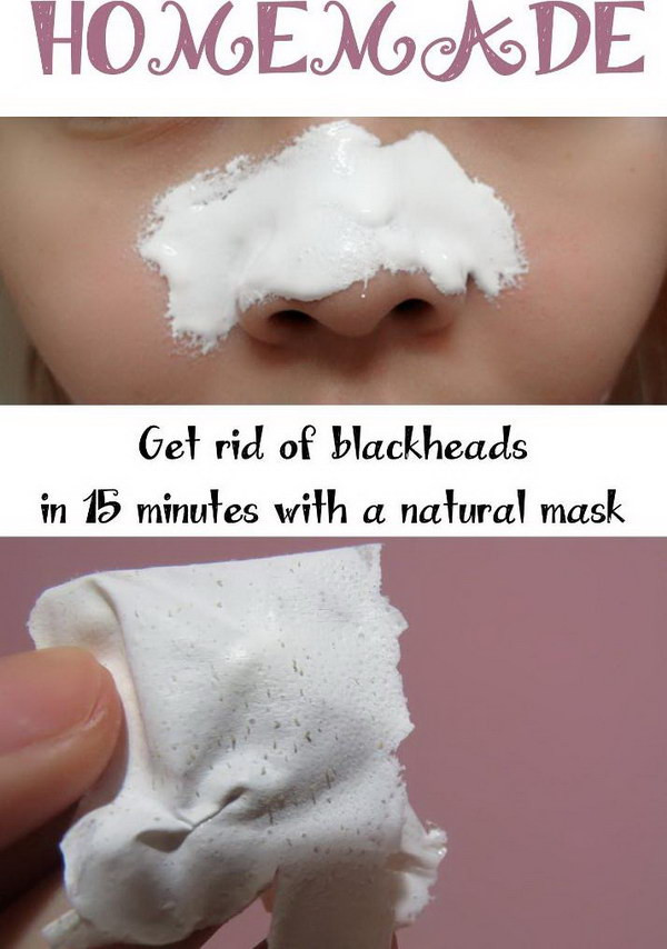 DIY Face Mask To Remove Blackheads
 Homemade Blackheads Remover Tutorials and Ideas Hative