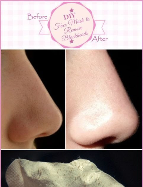 DIY Face Mask To Remove Blackheads<br />
 PinkFashion DIY Face Mask to Remove Blackheads