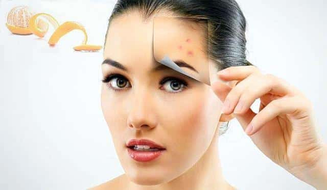 DIY Facial Mask For Acne Scars
 3 Incredible Acne Face Masks Including 1 For Acne Scars