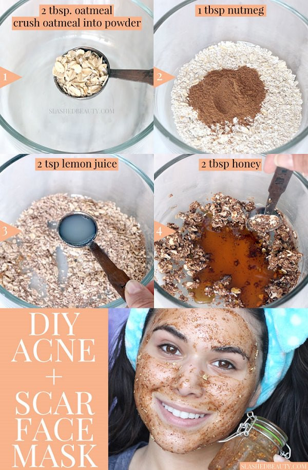 DIY Facial Masks
 Best DIY Face Mask for Acne & Acne Scars Honey & Nutmeg