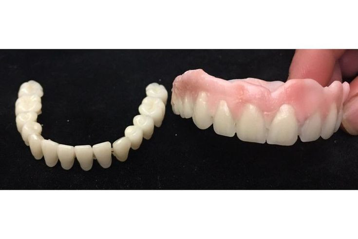 DIY False Teeth Kit
 Do It Yourself Denture Kit False Teeth Plus Dental