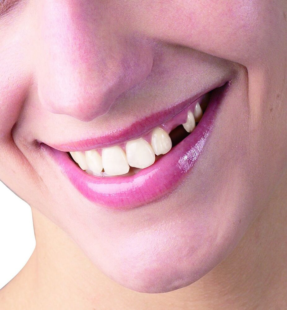 DIY False Teeth Kit
 TEMPORARY TOOTH REPAIR KIT diy FOR up TO 25 Teeth NO