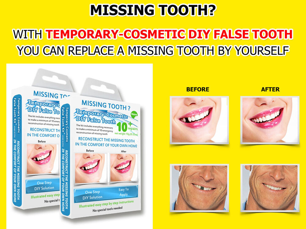 DIY False Teeth Kit
 2x Temporary Missing Tooth Repair Kit TEETH REPLACEMENT
