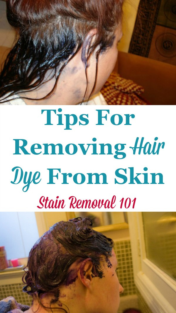 DIY Hair Dye Remover
 Tips For Removing Hair Dye From Skin