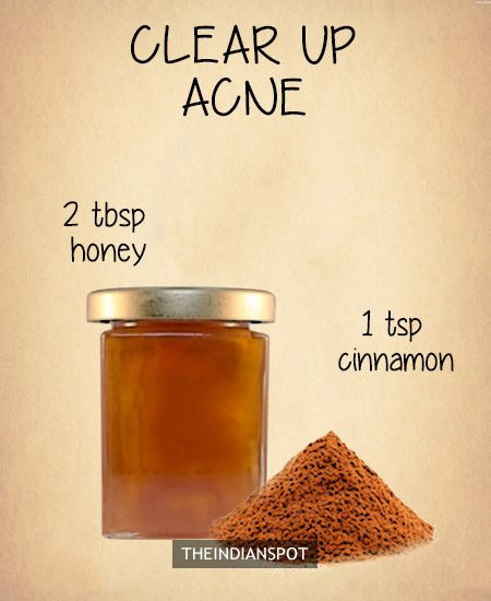 DIY Overnight Face Mask
 The Best Diy Overnight Face Mask for Acne – Home Family