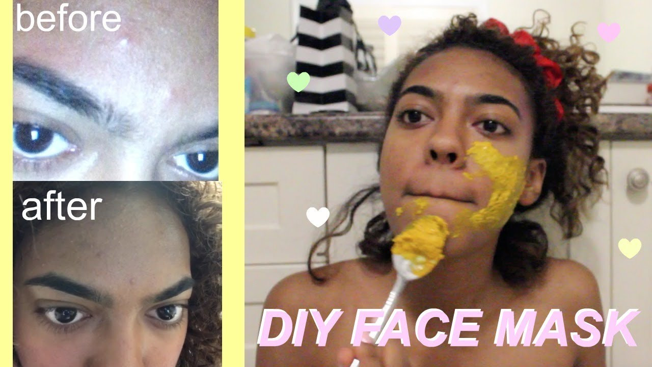 DIY Overnight Face Mask For Acne
 DIY Face Mask To Get Rid Acne OVERNIGHT RESULTS