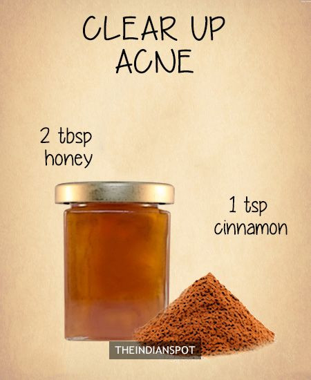 DIY Overnight Face Mask For Acne
 Pin on Skin
