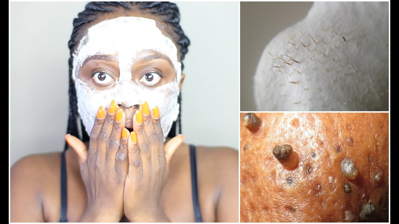 DIY Peel Off Face Mask With Egg
 BLACKHEAD REMOVAL PEEL OFF MASK USING EGG GET A FLAWLESS