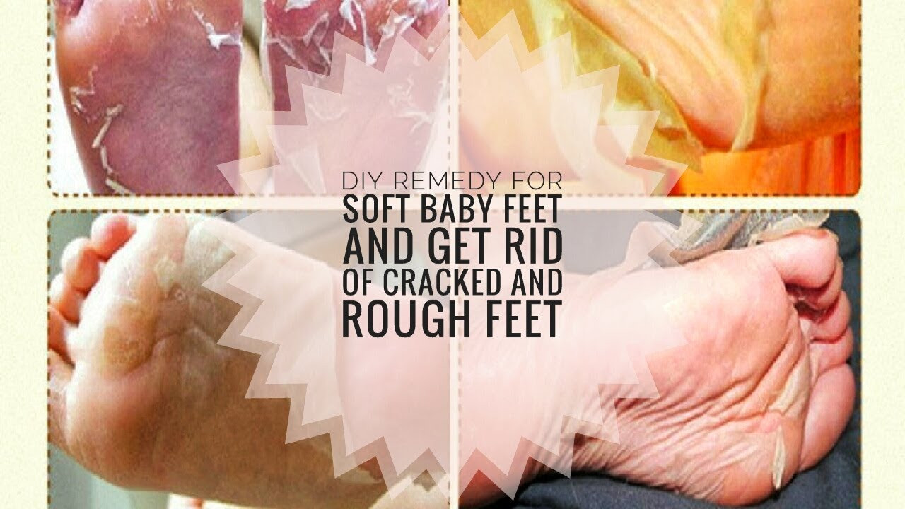 Foot Mask DIY
 CHEAP DIY FOOT MASK PEEL FOR SOFT BABY FEET AND GET RID OF