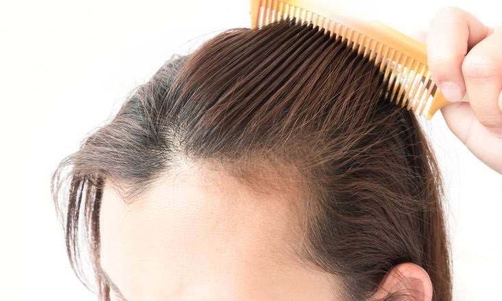Hairstyles For Female Hair Loss
 Dermatologist Provides Hair Loss Treatment for Women